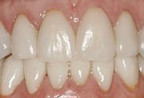 Sunny Smiles Family Dentistry | Thumb Sucking, Emergency Treatment and Implant Dentistry